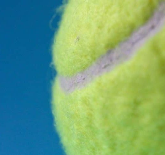 Learn About Tennis Elbow